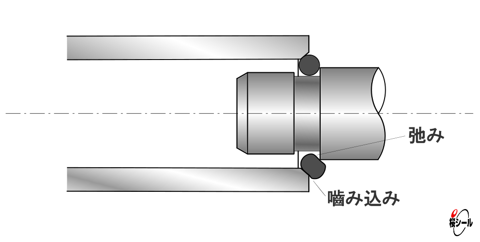 弛みによる噛み込み図.jpg